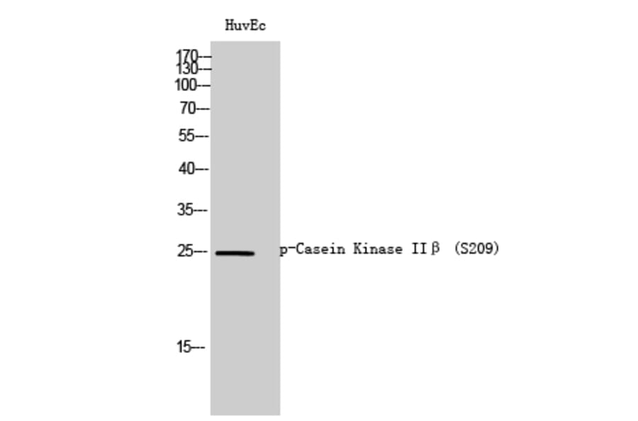 Western Blot - Anti-CKII-beta (phospho Ser209) Antibody (A0869) - Antibodies.com