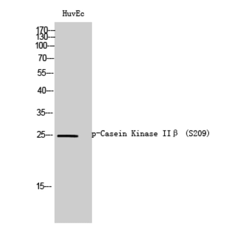 Western Blot - Anti-CKII-beta (phospho Ser209) Antibody (A0869) - Antibodies.com