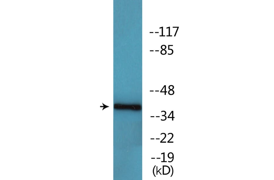 Western Blot - Anti-CK-1alpha (phospho Tyr294) Antibody (P12-1092) - Antibodies.com