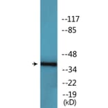 Western Blot - Anti-CK-1alpha (phospho Tyr294) Antibody (P12-1092) - Antibodies.com