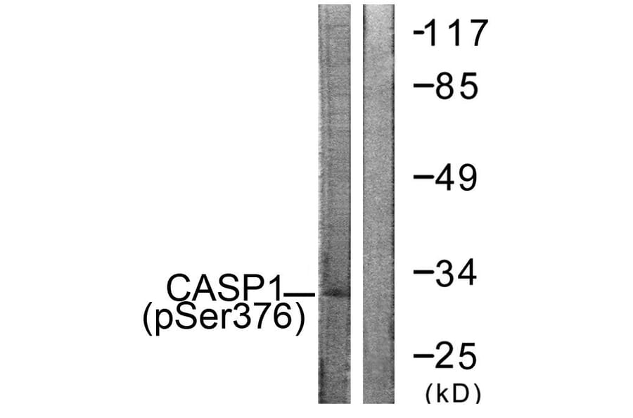 Western Blot - Anti-Caspase 1 (phospho Ser376) Antibody (A1025) - Antibodies.com
