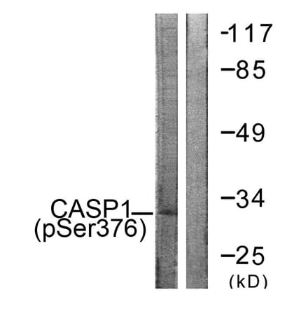Western Blot - Anti-Caspase 1 (phospho Ser376) Antibody (A1025) - Antibodies.com
