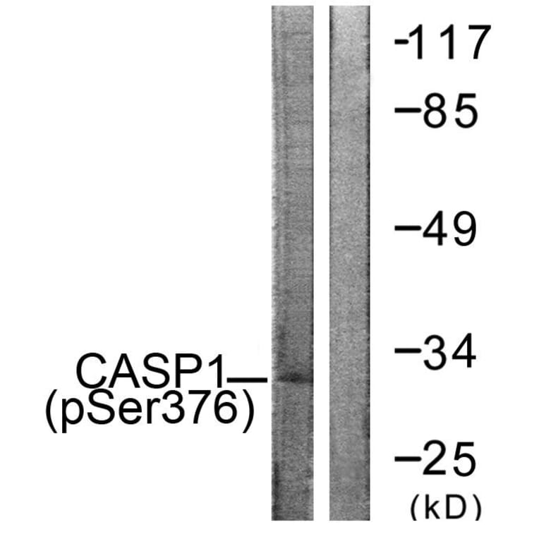 Western Blot - Anti-Caspase 1 (phospho Ser376) Antibody (A1025) - Antibodies.com