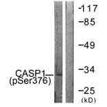 Western Blot - Anti-Caspase 1 (phospho Ser376) Antibody (A1025) - Antibodies.com