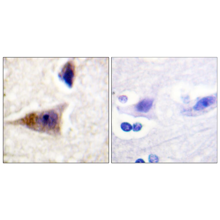 Immunohistochemistry - Anti-Caspase 1 (phospho Ser376) Antibody (A1025) - Antibodies.com