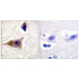 Immunohistochemistry - Anti-Caspase 1 (phospho Ser376) Antibody (A1025) - Antibodies.com