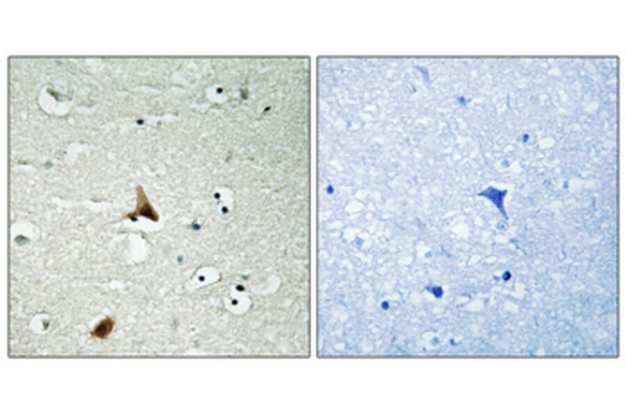 Immunohistochemistry - Anti-Caspase 1 (phospho Ser376) Antibody (A1025) - Antibodies.com