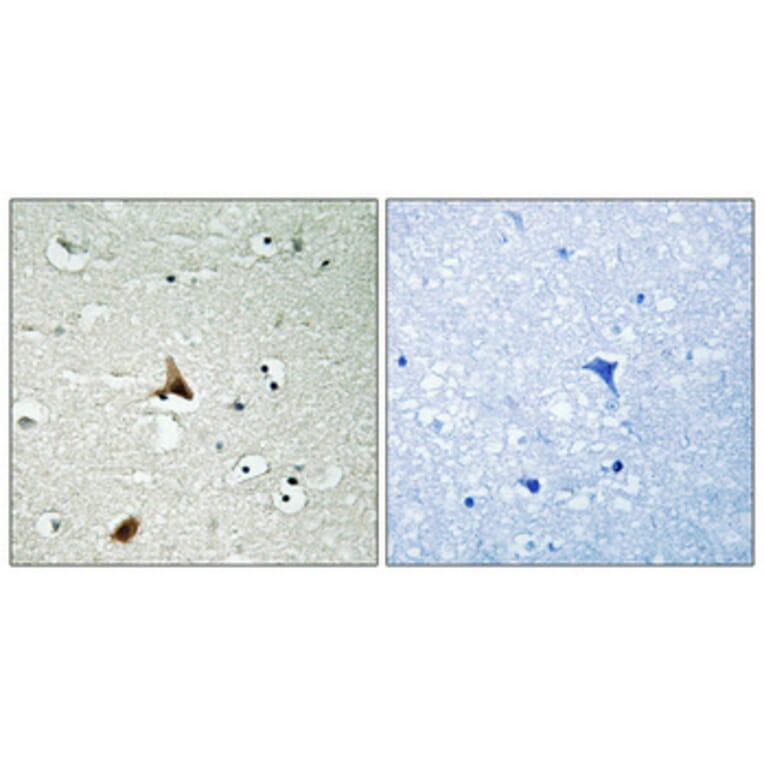 Immunohistochemistry - Anti-Caspase 1 (phospho Ser376) Antibody (A1025) - Antibodies.com