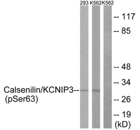 Western Blot - Anti-Calsenilin (phospho Ser63) Antibody (A1024) - Antibodies.com