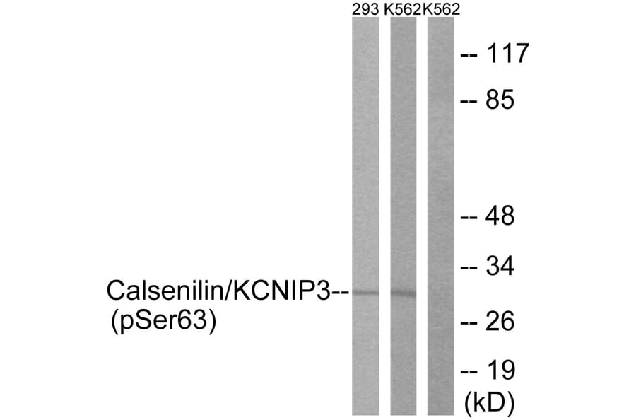 Western Blot - Anti-Calsenilin (phospho Ser63) Antibody (A1024) - Antibodies.com