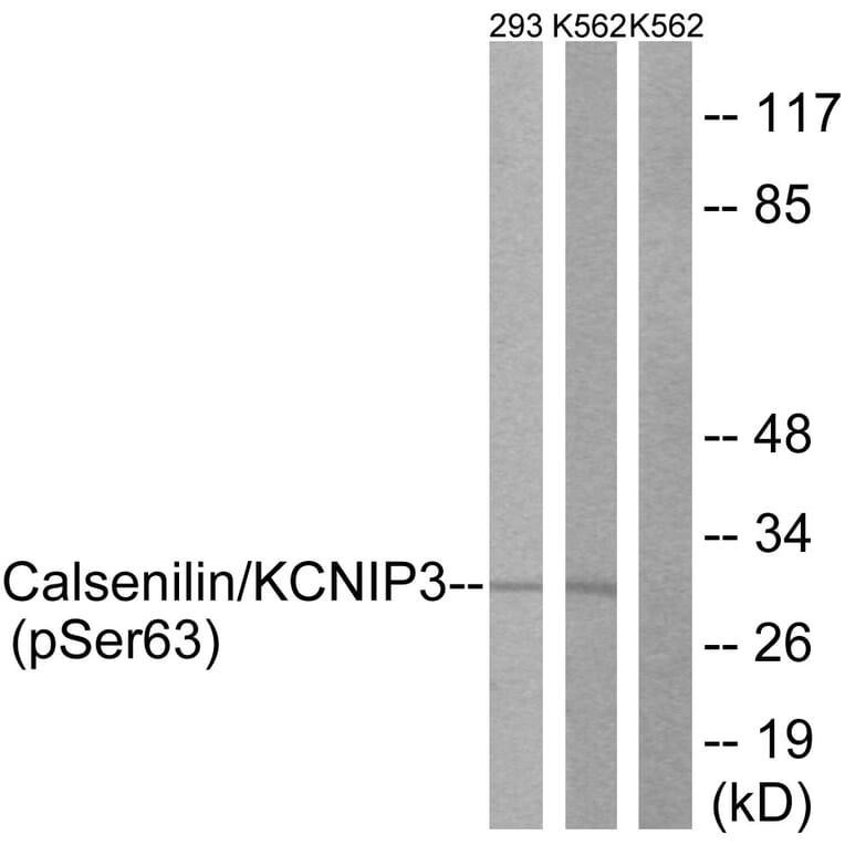 Western Blot - Anti-Calsenilin (phospho Ser63) Antibody (A1024) - Antibodies.com