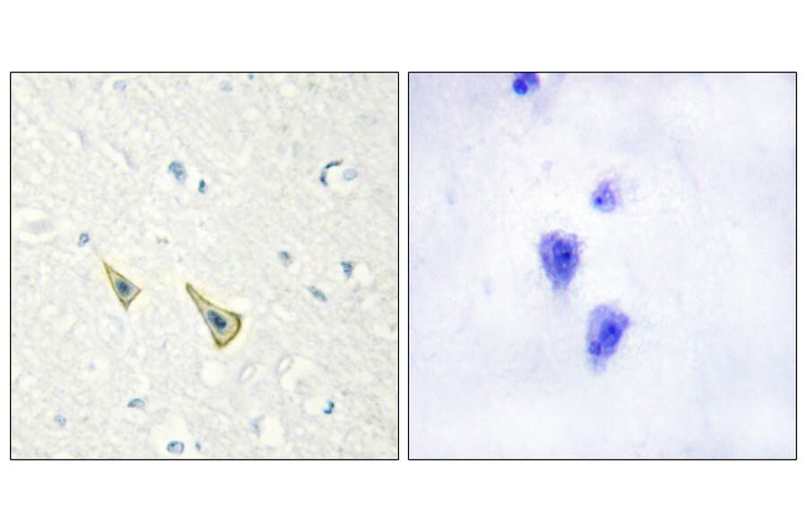 Immunohistochemistry - Anti-Calsenilin (phospho Ser63) Antibody (A1024) - Antibodies.com