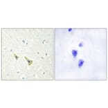 Immunohistochemistry - Anti-Calsenilin (phospho Ser63) Antibody (A1024) - Antibodies.com