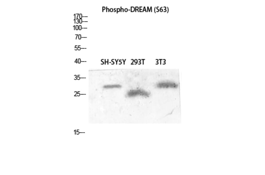 Western Blot - Anti-Calsenilin (phospho Ser63) Antibody (A1024) - Antibodies.com