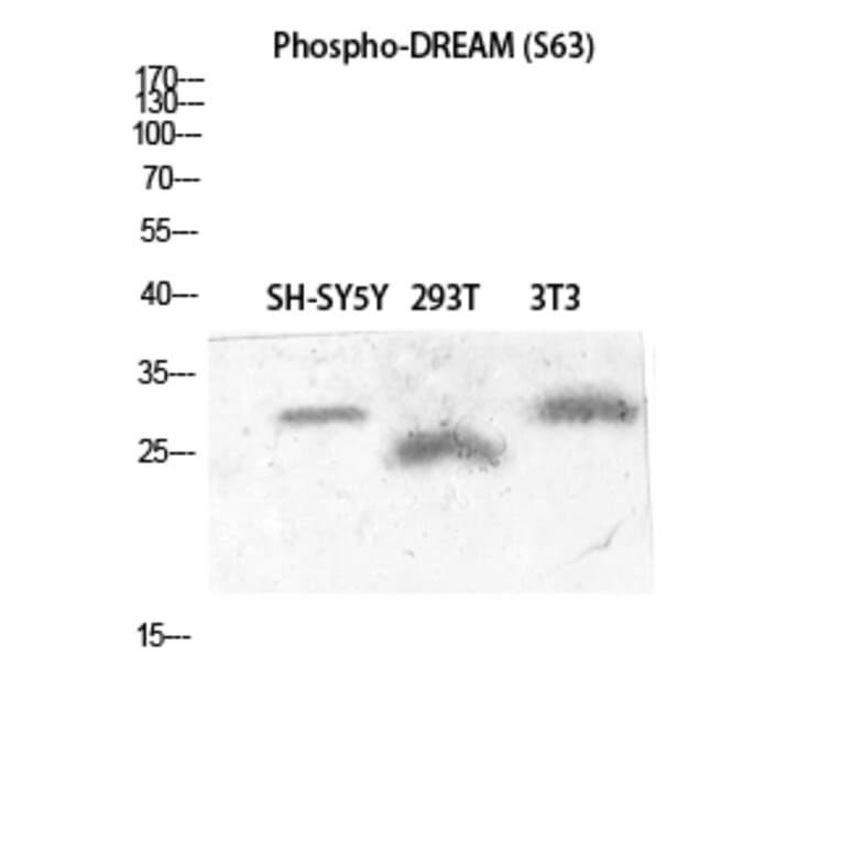 Western Blot - Anti-Calsenilin (phospho Ser63) Antibody (A1024) - Antibodies.com