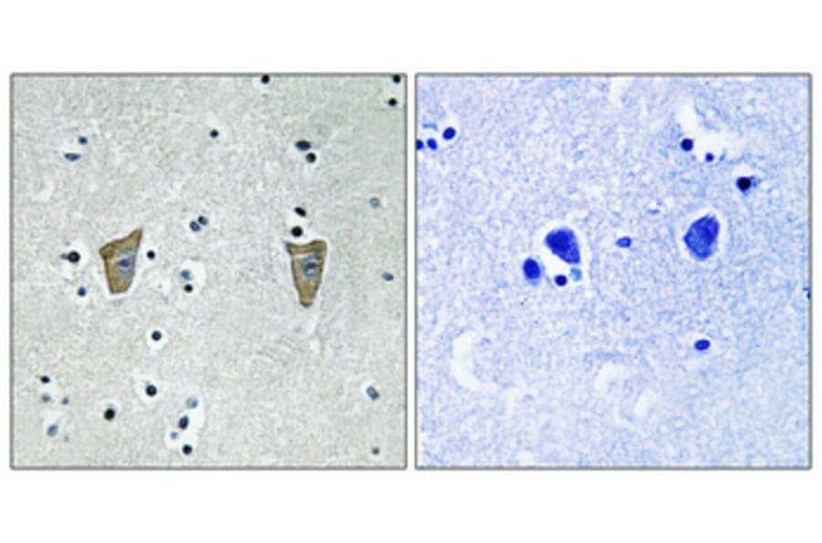 Immunohistochemistry - Anti-Calsenilin (phospho Ser63) Antibody (A1024) - Antibodies.com