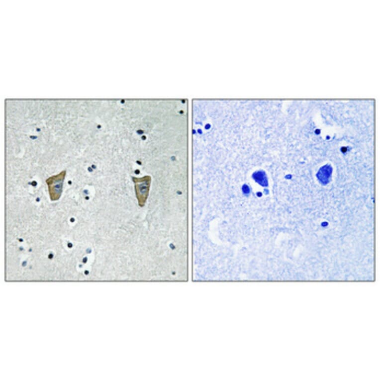 Immunohistochemistry - Anti-Calsenilin (phospho Ser63) Antibody (A1024) - Antibodies.com