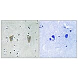Immunohistochemistry - Anti-Calsenilin (phospho Ser63) Antibody (A1024) - Antibodies.com