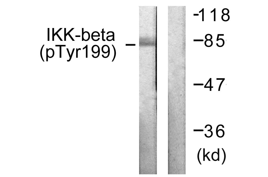 Western Blot - Anti-IKK-beta (phospho Tyr199) Antibody (A0490) - Antibodies.com