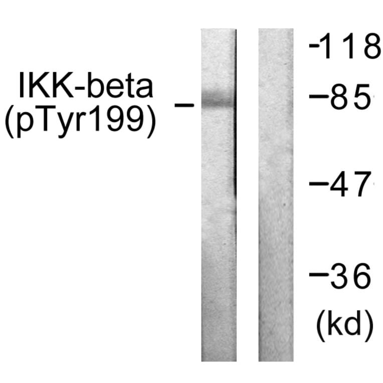 Western Blot - Anti-IKK-beta (phospho Tyr199) Antibody (A0490) - Antibodies.com