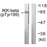 Western Blot - Anti-IKK-beta (phospho Tyr199) Antibody (A0490) - Antibodies.com