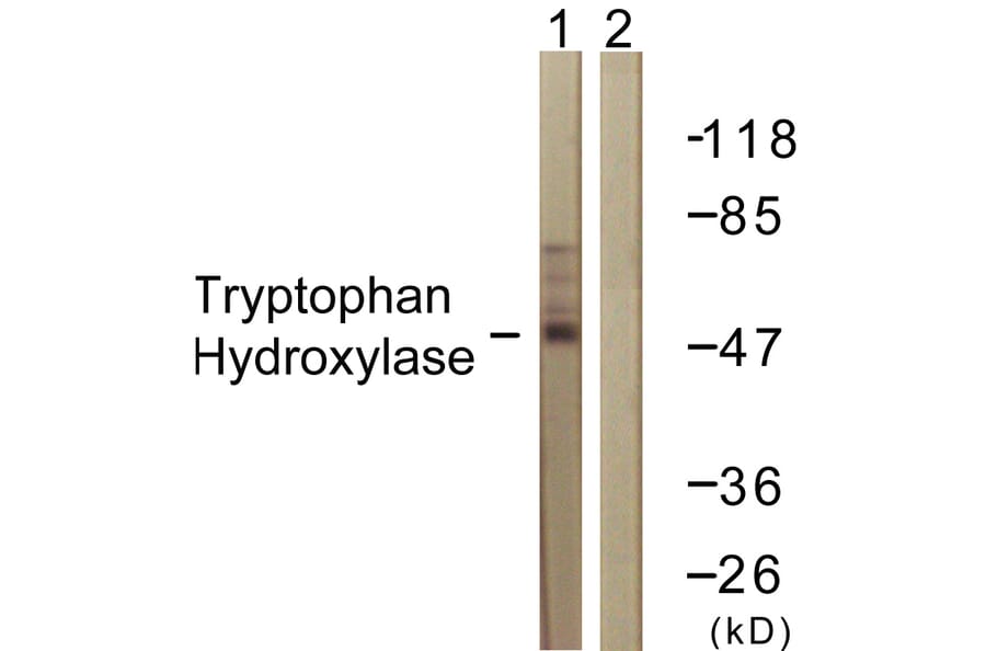 Western Blot - Anti-Tryptophan Hydroxylase Antibody (B1012) - Antibodies.com