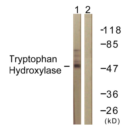 Western Blot - Anti-Tryptophan Hydroxylase Antibody (B1012) - Antibodies.com
