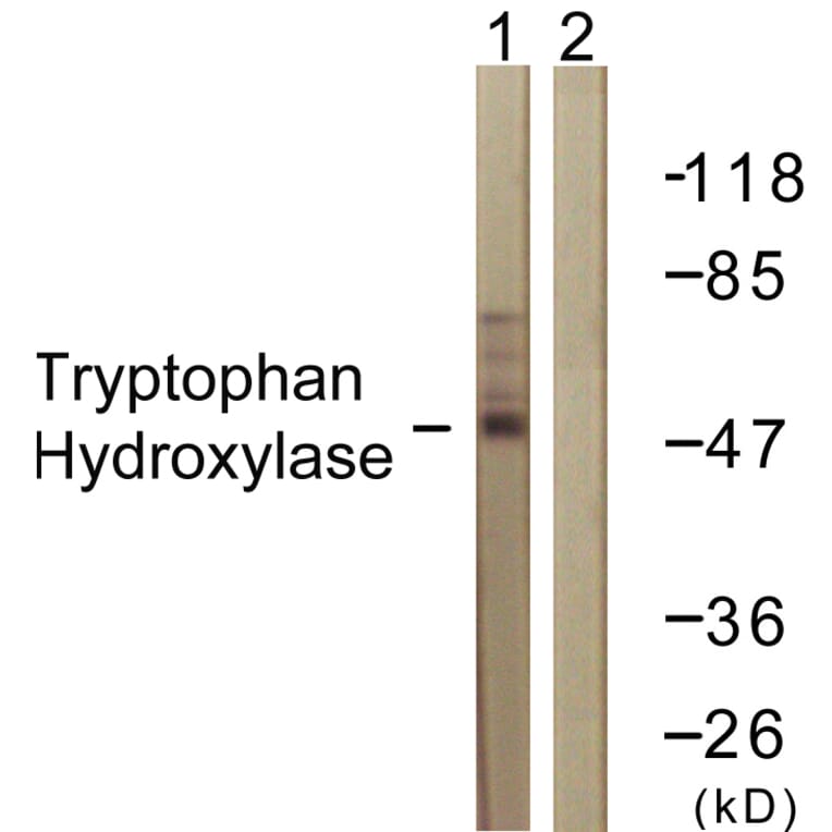 Western Blot - Anti-Tryptophan Hydroxylase Antibody (B1012) - Antibodies.com