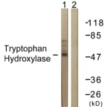 Western Blot - Anti-Tryptophan Hydroxylase Antibody (B1012) - Antibodies.com