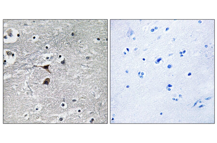 Immunohistochemistry - Anti-Tryptophan Hydroxylase Antibody (B1012) - Antibodies.com