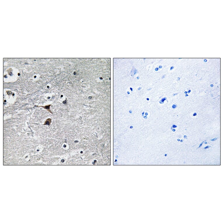 Immunohistochemistry - Anti-Tryptophan Hydroxylase Antibody (B1012) - Antibodies.com