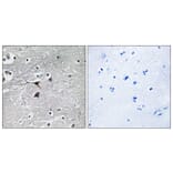Immunohistochemistry - Anti-Tryptophan Hydroxylase Antibody (B1012) - Antibodies.com