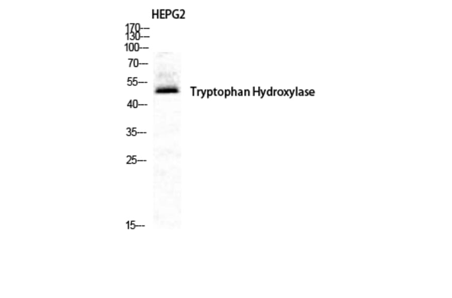 Western Blot - Anti-Tryptophan Hydroxylase Antibody (B1012) - Antibodies.com