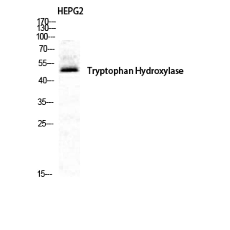 Western Blot - Anti-Tryptophan Hydroxylase Antibody (B1012) - Antibodies.com