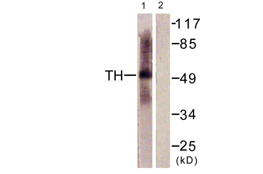 Western Blot - Anti-Tryptophan Hydroxylase Antibody (B1011) - Antibodies.com