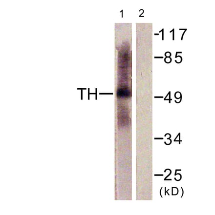 Western Blot - Anti-Tryptophan Hydroxylase Antibody (B1011) - Antibodies.com