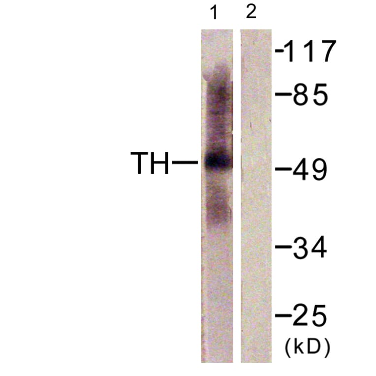 Western Blot - Anti-Tryptophan Hydroxylase Antibody (B1011) - Antibodies.com