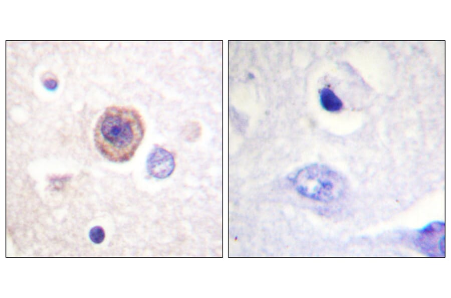 Immunohistochemistry - Anti-Tryptophan Hydroxylase Antibody (B1011) - Antibodies.com