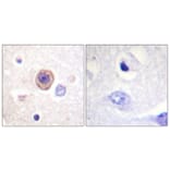 Immunohistochemistry - Anti-Tryptophan Hydroxylase Antibody (B1011) - Antibodies.com