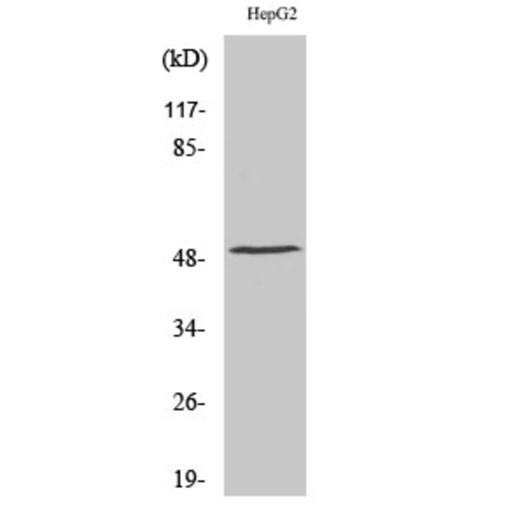 Western Blot - Anti-Tryptophan Hydroxylase Antibody (B1011) - Antibodies.com