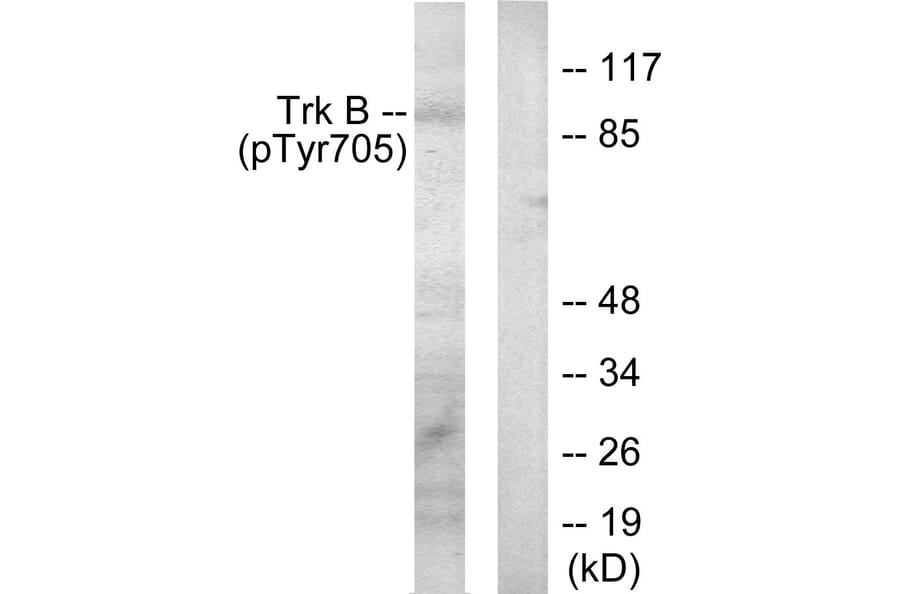 Western Blot - Anti-Trk B (phospho Tyr705) Antibody (A0036) - Antibodies.com