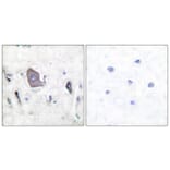 Immunohistochemistry - Anti-Trk B (phospho Tyr705) Antibody (A0036) - Antibodies.com