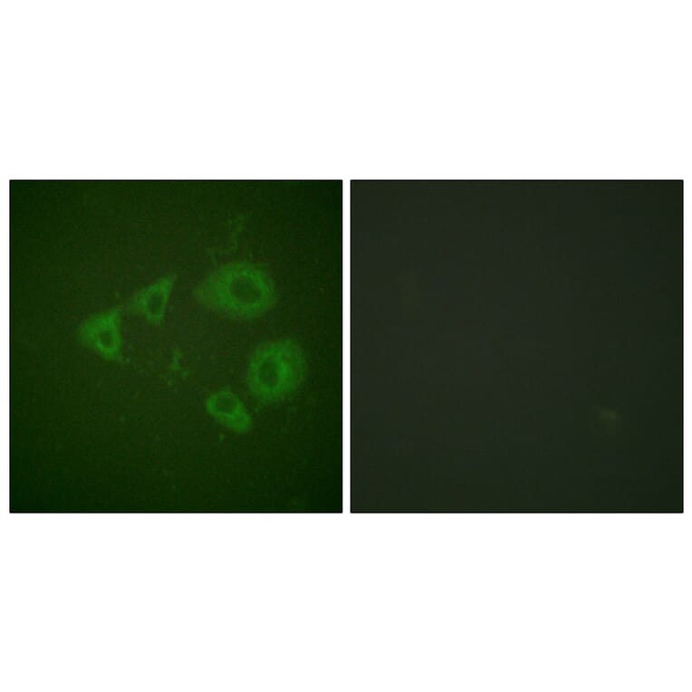 Immunofluorescence - Anti-Trk B (phospho Tyr705) Antibody (A0036) - Antibodies.com