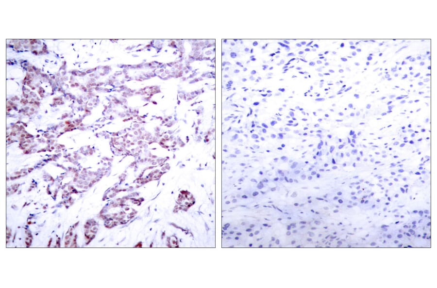 Western Blot - Anti-STAT6 (phospho Thr645) Antibody (A7228) - Antibodies.com