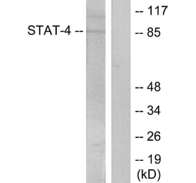 Western Blot - Anti-STAT4 (phospho Tyr693) Antibody (A7225) - Antibodies.com