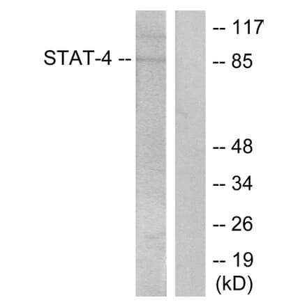 Western Blot - Anti-STAT4 (phospho Tyr693) Antibody (A7225) - Antibodies.com