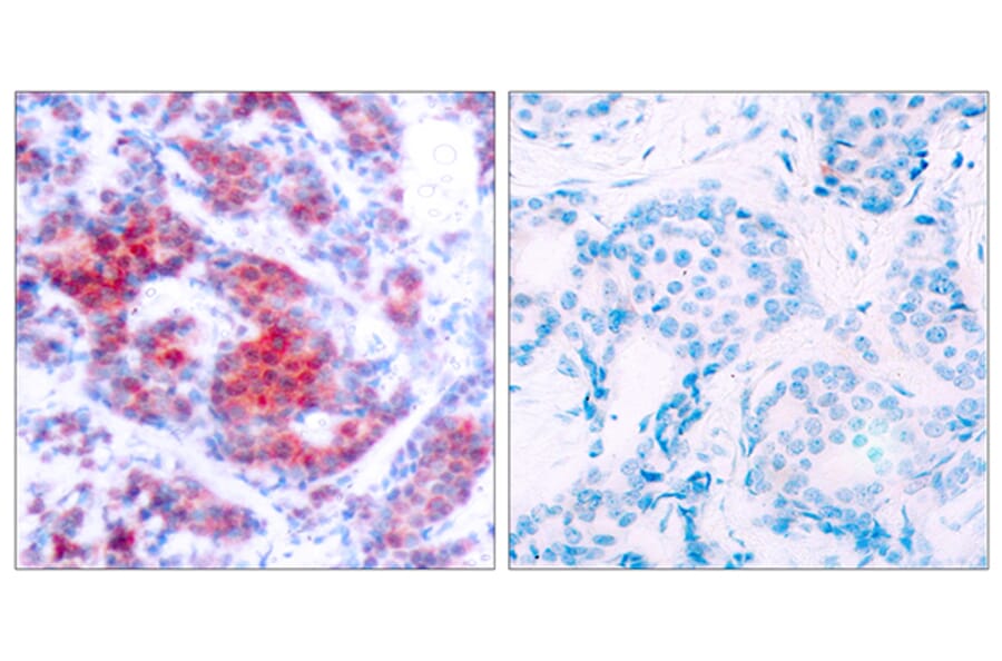 Immunohistochemistry - Anti-STAT4 (phospho Tyr693) Antibody (A7225) - Antibodies.com