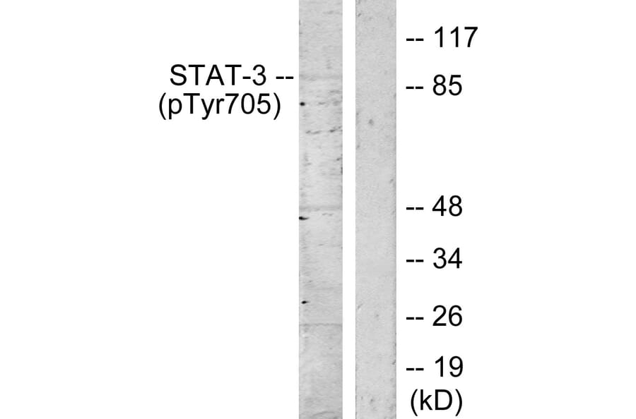 Western Blot - Anti-STAT3 (phospho Tyr705) Antibody (A7224) - Antibodies.com