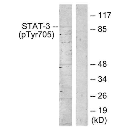 Western Blot - Anti-STAT3 (phospho Tyr705) Antibody (A7224) - Antibodies.com