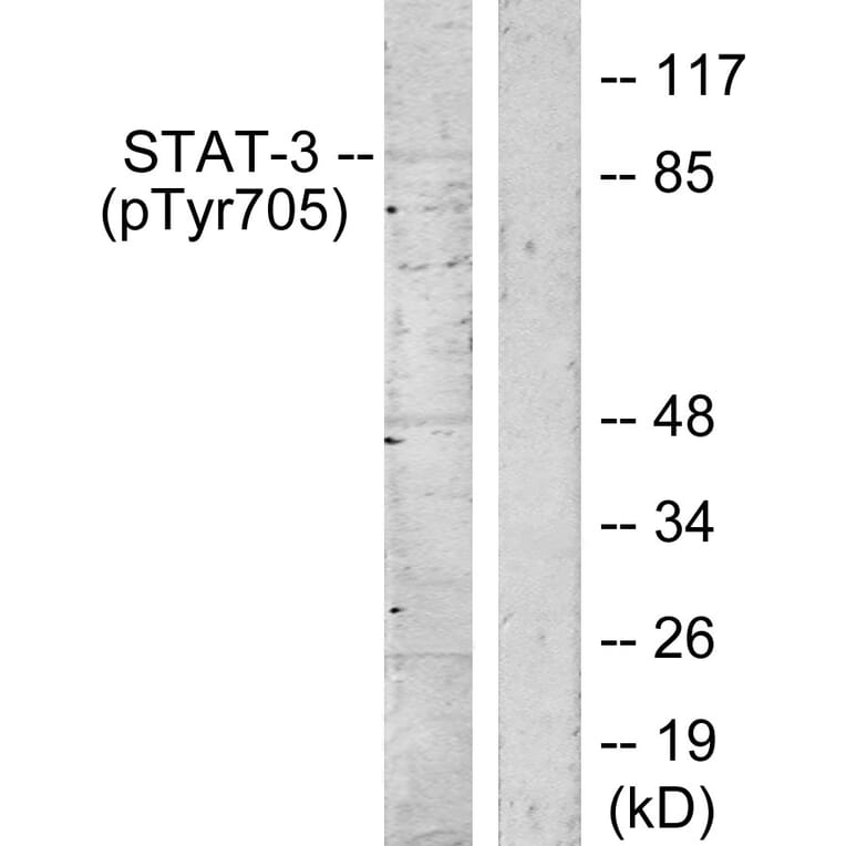 Western Blot - Anti-STAT3 (phospho Tyr705) Antibody (A7224) - Antibodies.com